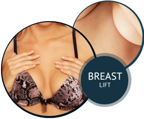 Breast Lift