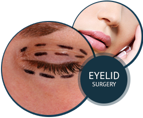 Eyelid Surgery